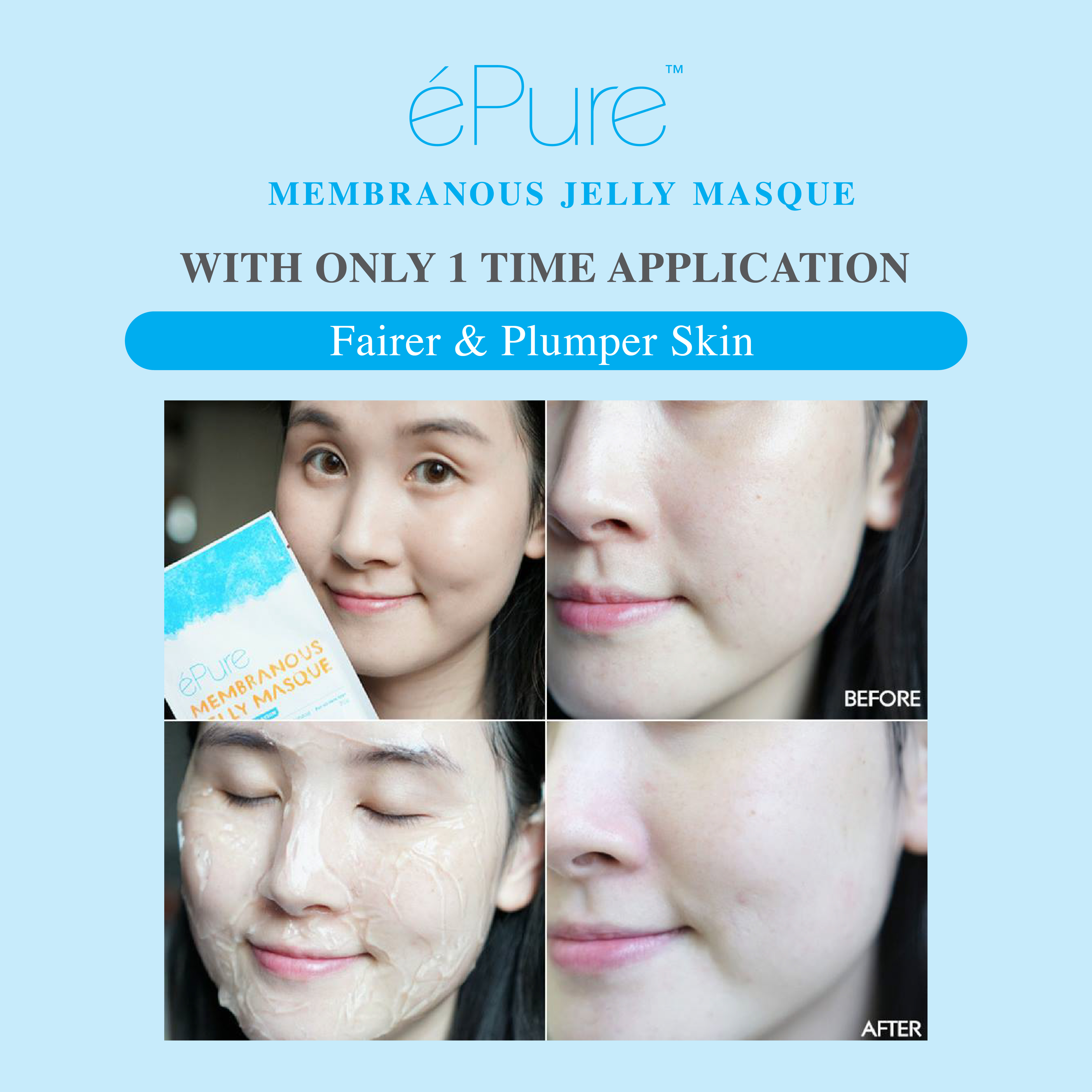 Customer testimonial before and after result after using &eacute;Pure Membranous Jelly Masque