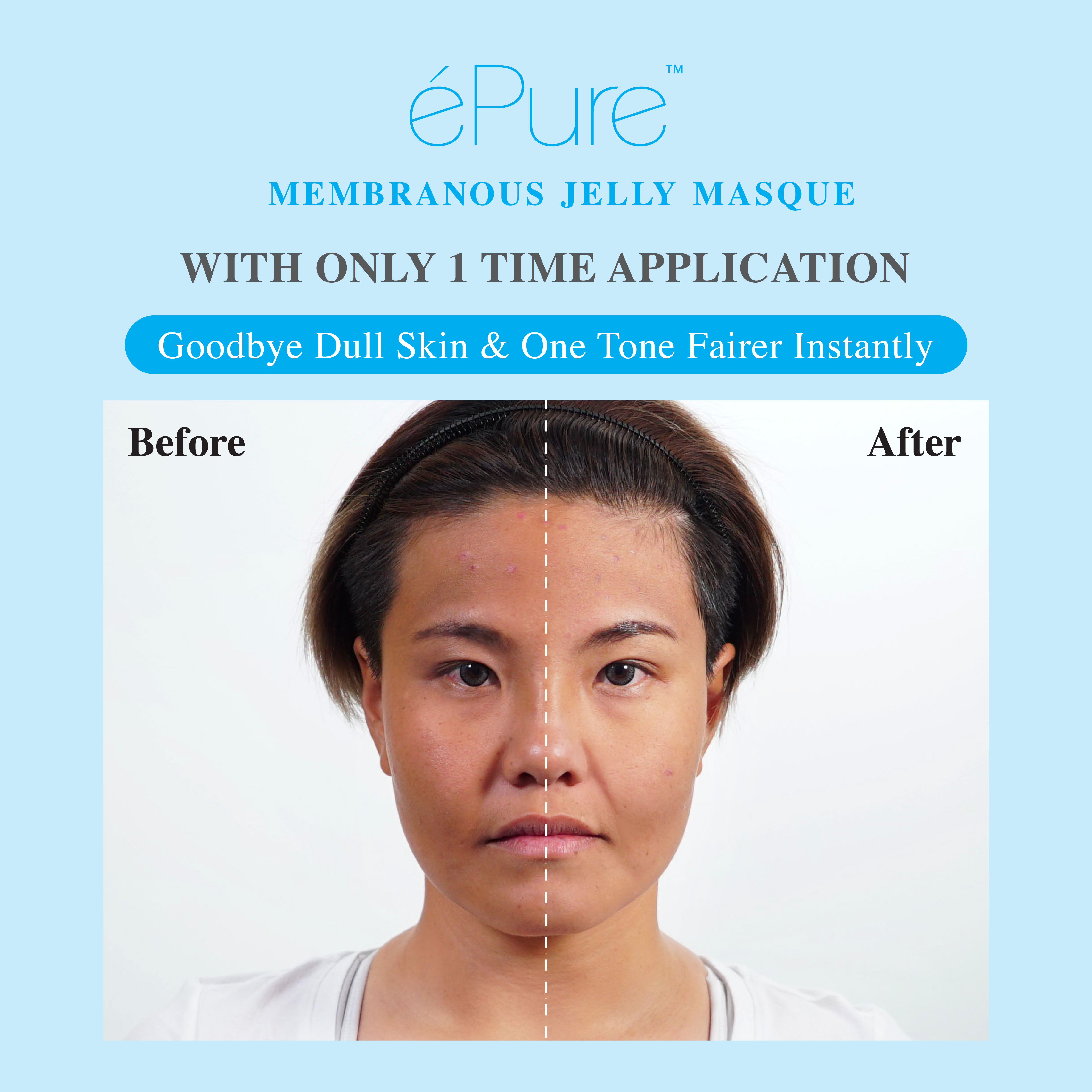 Customer testimonial before and after result after using &eacute;Pure Membranous Jelly Masque