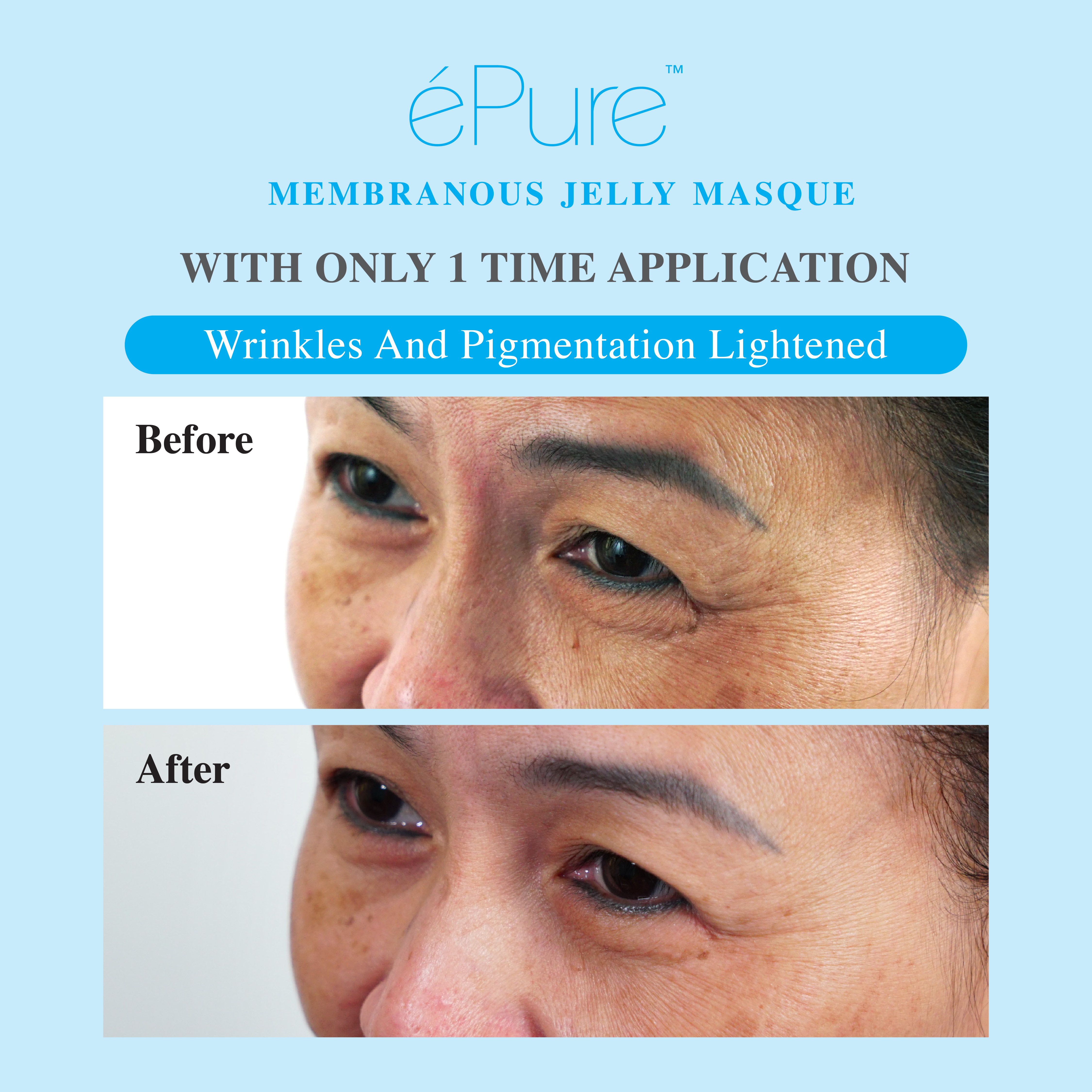 Customer testimonial before and after result after using &eacute;Pure Membranous Jelly Masque